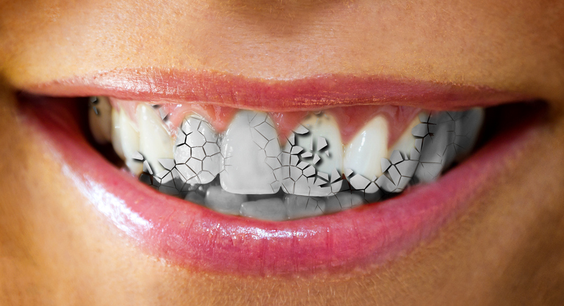 everything you need to know about cracked teeth city square dental crack teeth